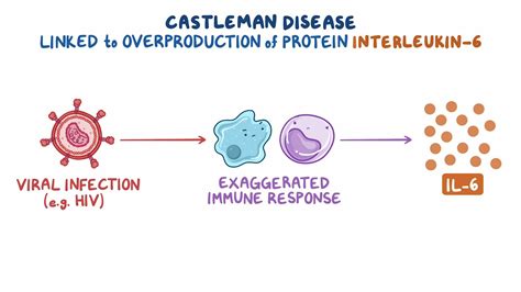 Castleman disease: Year of the Zebra: Video & Anatomy | Osmosis