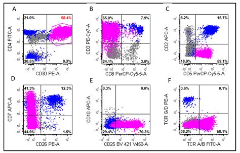 Cancers | Free Full-Text | The Leukemic Phase of ALK-Negative Anaplastic Large Cell Lymphoma Is ...