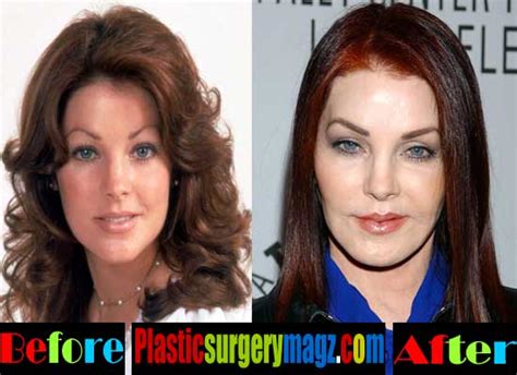 Priscilla Presley Plastic Surgery Disaster | Plastic Surgery Magazine