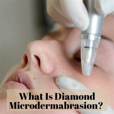 The Benefits of Diamond Microdermabrasion - HubPages