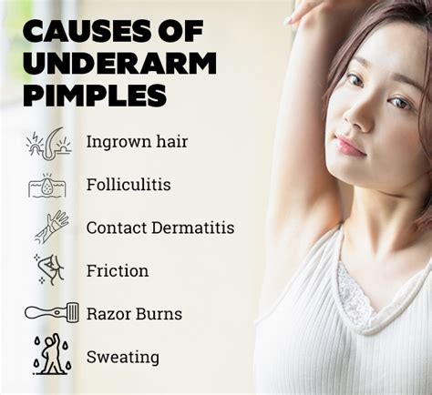 Got Pimples in Your Armpit? Here's Everything You Need To Know