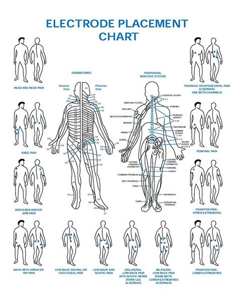 Electrode Placement Chart | Tens electrodes, Tens electrode placement ...