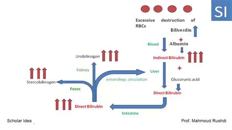 Hemolytic, hepatic and obstructive Jaundice explained !!! - YouTube