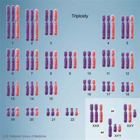 Can changes in the number of chromosomes affect health and development?: MedlinePlus Genetics