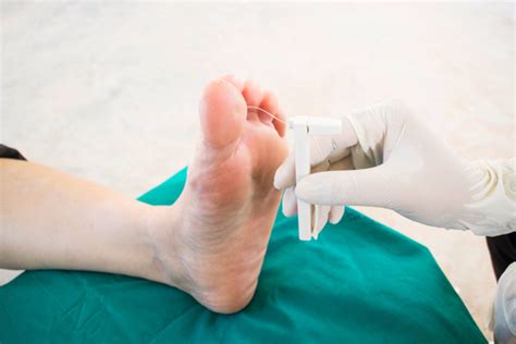 Diabetic Foot Examination - Reduce Risk Of Ulceration