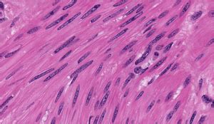 Cardiac Muscle Histology Cross Section