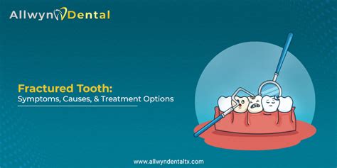 What is a Fractured Tooth | Fractured Tooth Symptoms, Causes, and ...