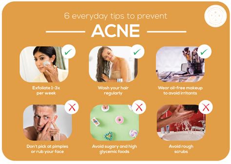 How To Help Prevent Acne - Buildingrelationship21