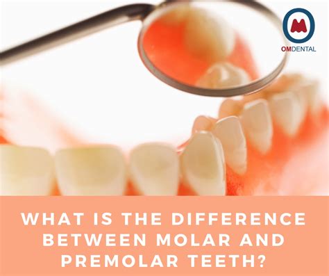 How do Molars and Premolars Differ?