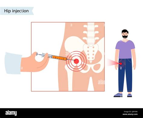 Hip joint injection, illustration Stock Photo - Alamy