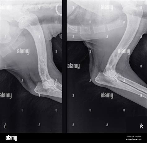 X-ray of the front leg of a young dog with enostosis or panosteitis with increased opacity and ...