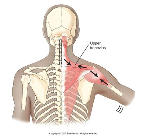 Six Causes of Shoulder Impingement Syndrome - Part 1