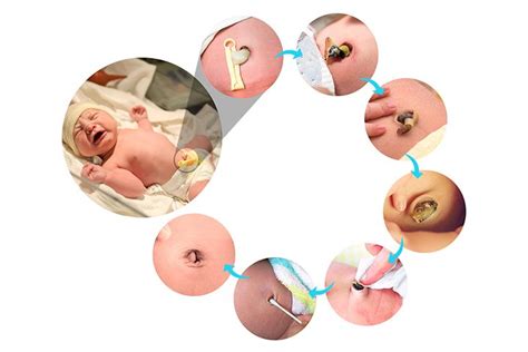 What Happens To The Umbilical Cord After Your Baby Is Born? | Baby umbilical cord, Umbilical ...