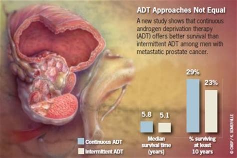 Survival Better with Continuous ADT - Renal and Urology News