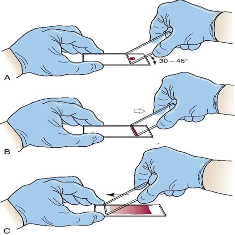 Chọc Hút Kim Nhỏ (FNA) | Bài giảng CĐHA