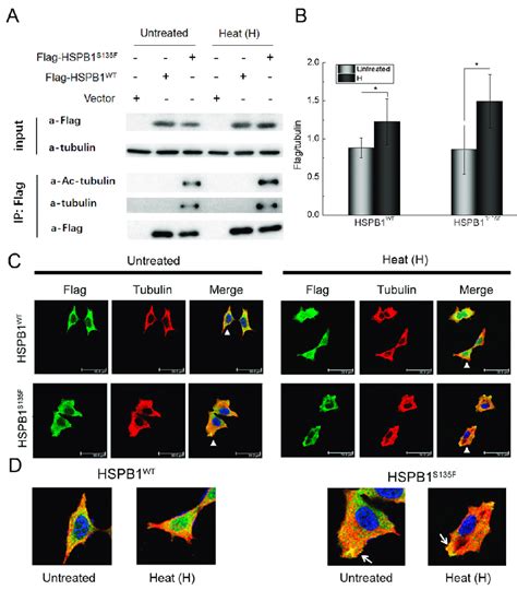 HSPB1 S135F binds to α-tubulin and acetylated α-tubulin. (A,B) Western... | Download Scientific ...