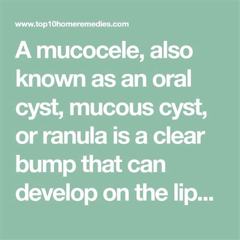 Mucocele: Diagnosis, Treatment, and Self-Care Tips | Medical knowledge, Home remedies, Health ...