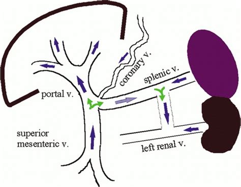 Hepatofugal Flow Ultrasound