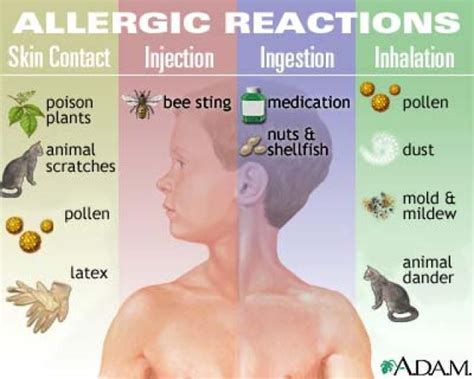 Anaphylaxis Treatment / Difference Between Anaphylaxis and Anaphylactic Shock ... - During an ...