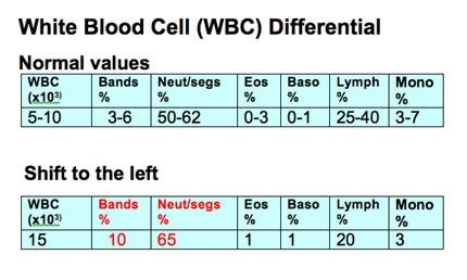 Example Resume: Example Cbc With Left Shift