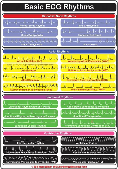 Ekg Interpretation Cheat Sheet Printable Printable Word Searches | Porn Sex Picture