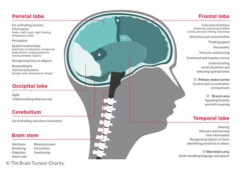 Brain tumour location and symptoms | The Brain Tumour Charity