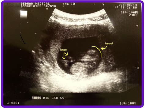 First prenatal appointment! - My Little Pea Sprout