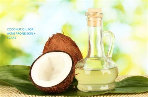 Coconut Oil For Acne + How To Use For Face And Scars - Best Acne Treatments That Work