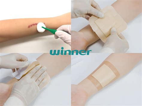 Perfect Choice of Wound Care Products: Winner Medical’s Disposables