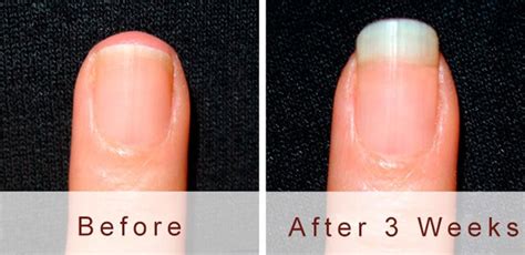 Biotin Intake for Nails: Good or Bad Idea? – NailDesignCode