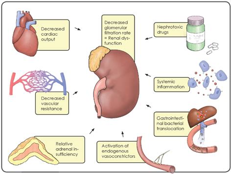 Acute kidney injury and hepatorenal syndrome in cirrhosis - Egerod ...