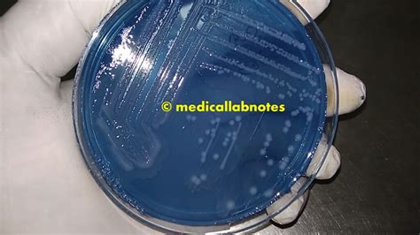 CLED Agar: Introduction, Composition, Principle, Preparation, Testing Procedure, Colony ...