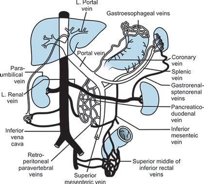 Coronary Vein Portal Hypertension