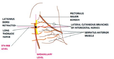 Landmarks of serratus anterior plane block. Figure 3:Schematic... | Download Scientific Diagram