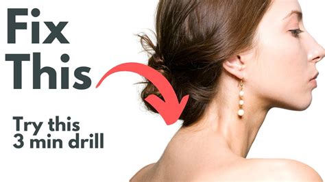 Fix Neck Hump with 3 Minute Drill - YouTube