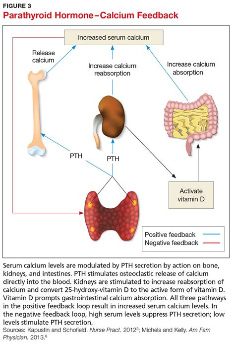 Primary Hyperparathyroidism: A Case-based Review | Clinician Reviews