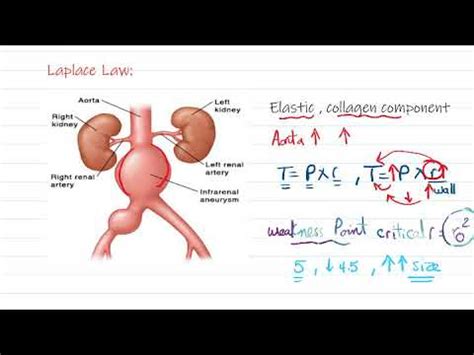 Laplace Law and applications of hemodynamics - YouTube