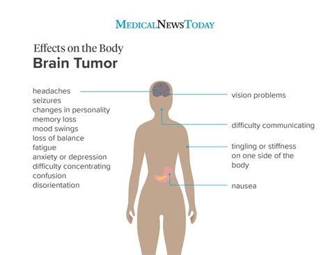 Early symptoms of a brain tumor: Mental and physical signs