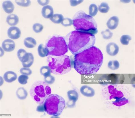 Immature Cells In Myeloid Serie Myelocyte Metamyelocyte Stock Photo - Download Image Now - iStock