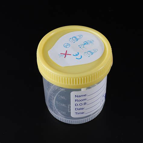 Sterile Vacuum Urine Sample Collection Cup 90ml Vacuum Urine Container ...