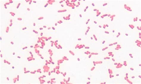 Serratia marcescens antibiotics