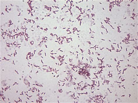 Campylobacter. Causes, symptoms, treatment Campylobacter