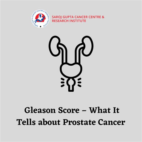 Gleason Score – What It Tells about Prostate Cancer