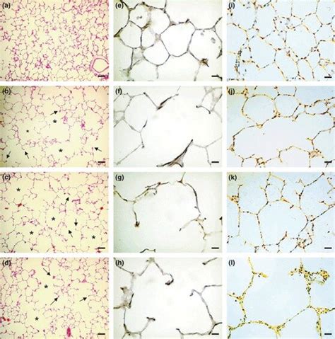 Photomicrographs of lung parenchyma histology 50 days after ...