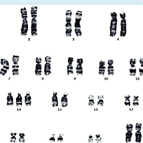 Schematic of the uniparental disomy inheritance pattern that mosaic... | Download Scientific Diagram