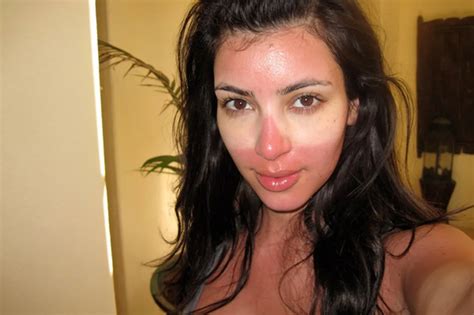 How to Get Rid of Sunburn Fast, Reduce Redness & Prevent Peeling | Glamour Sunburn On Face, Get ...