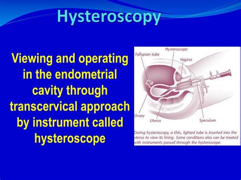 PPT - Hysteroscopy PowerPoint Presentation, free download - ID:4129835