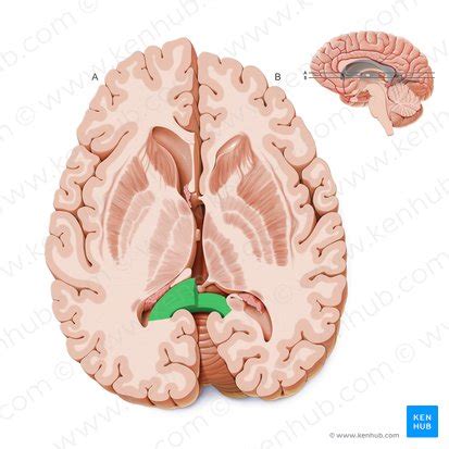 Corpus callosum: Anatomy, function and clinical aspects | Kenhub