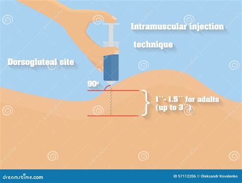 Intramuscular Injection Technique Vector Illustration. Technique Of Intramuscular Route Of ...