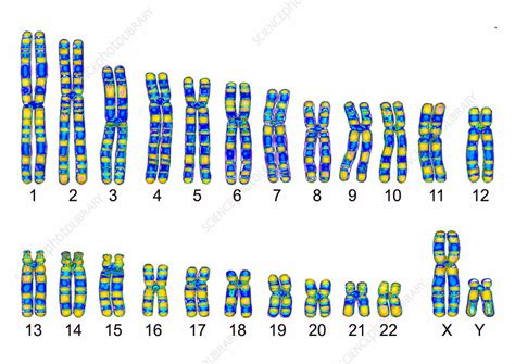 Human Karyotype - Stock Image - C013/0007 - Science Photo Library